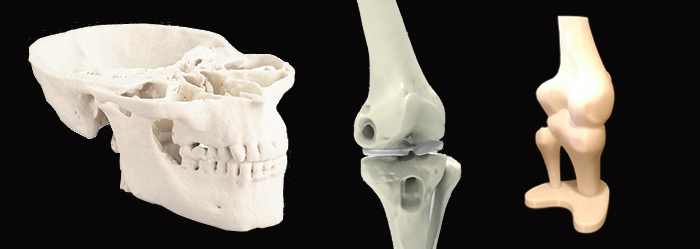 Modelo practica ciruga - Impresin 3D Medical